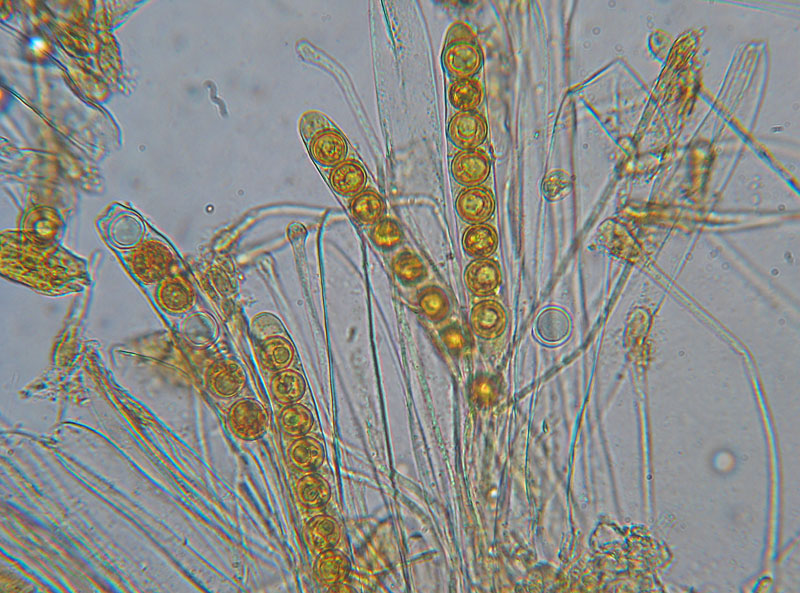 Sphaerosporella brunnea